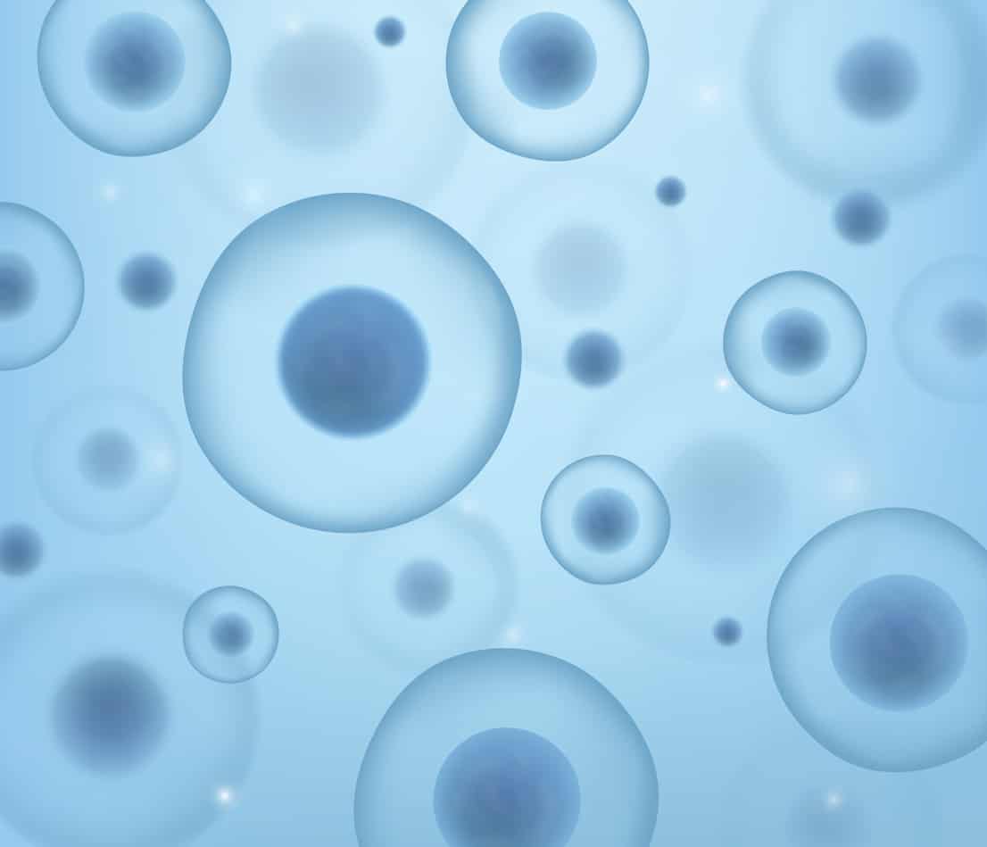 Same-Day Stromal Cell Treatment for Pattern Baldness